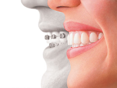 The image features a split-screen of two people s faces with smiling teeth, symbolizing oral health and dental care.