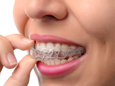 A person with braces examining their teeth, focusing on a specific area while holding up a finger.