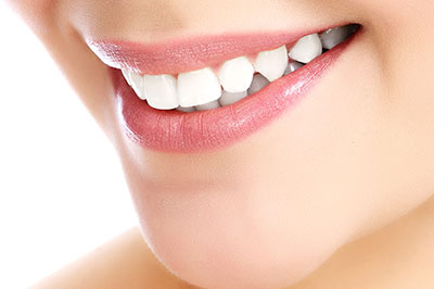 The image shows a close-up of a person s face with a focus on their teeth and lips, highlighting dental care or cosmetic treatments.