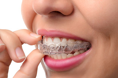 A woman with braces is holding her finger near her mouth, possibly in the process of adjusting them.