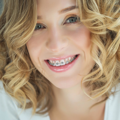 The image shows a young woman with straight teeth smiling at the camera, wearing braces, against a neutral background.