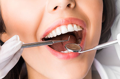 A woman with open mouth undergoing dental treatment, with visible dental tools and instruments, including a drill and a tray of dental supplies.